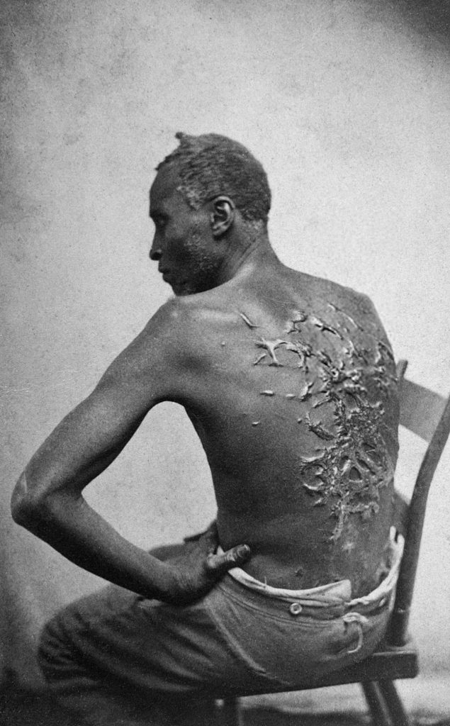 A photographic portrait of a black man sitting in a chair, back exposed to us. Across his pack are marks of prior whipping and beating, scarification.