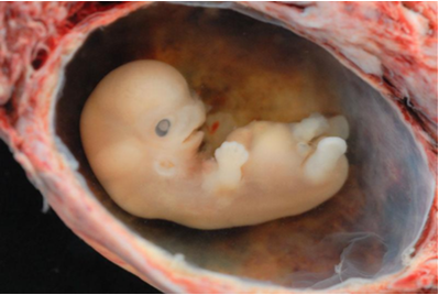Embryo inside a stomach