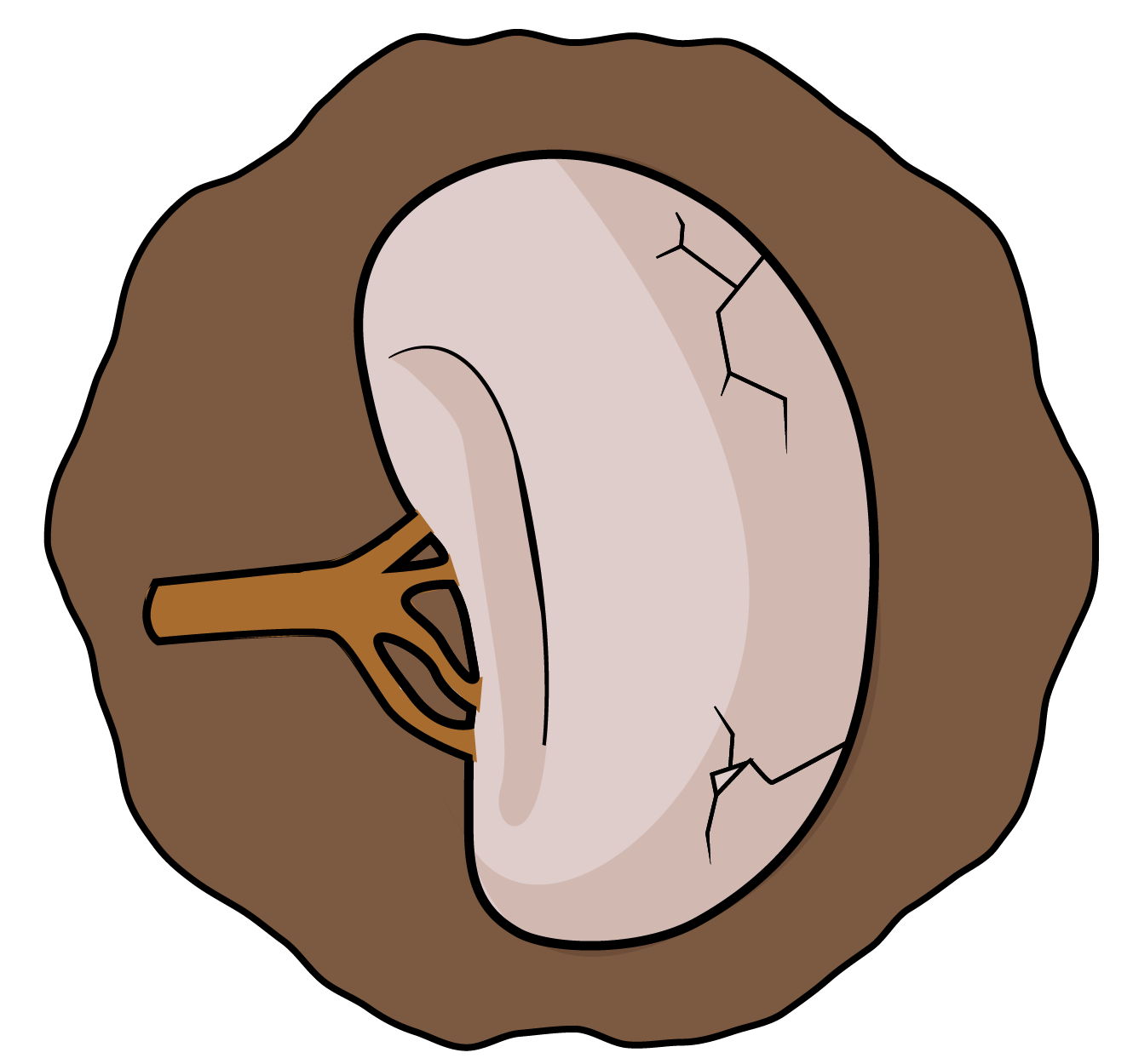 An illustration of a kidney that is fracturing in front of a brown round shape.