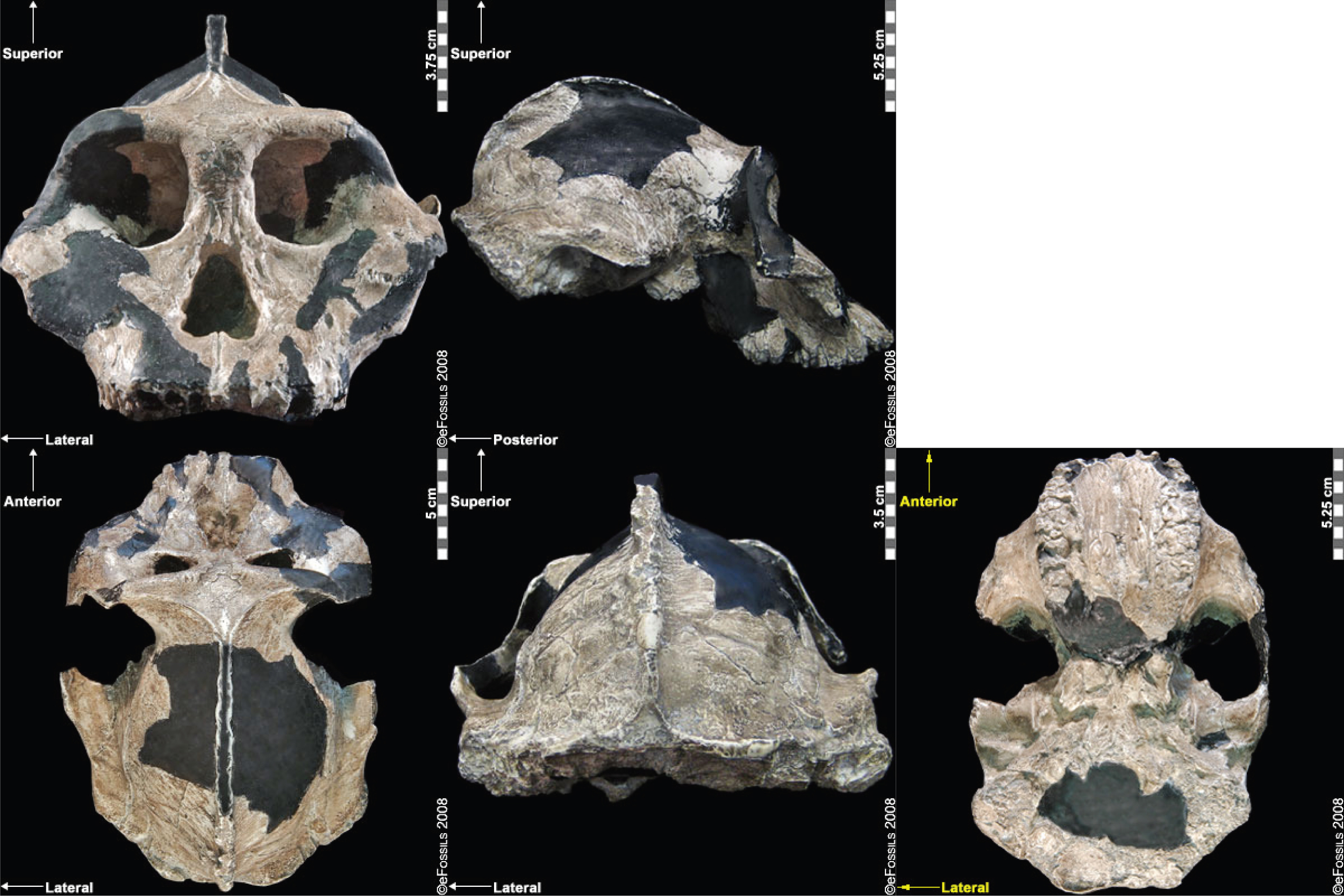 Five views of a beige partial skull on a black background.