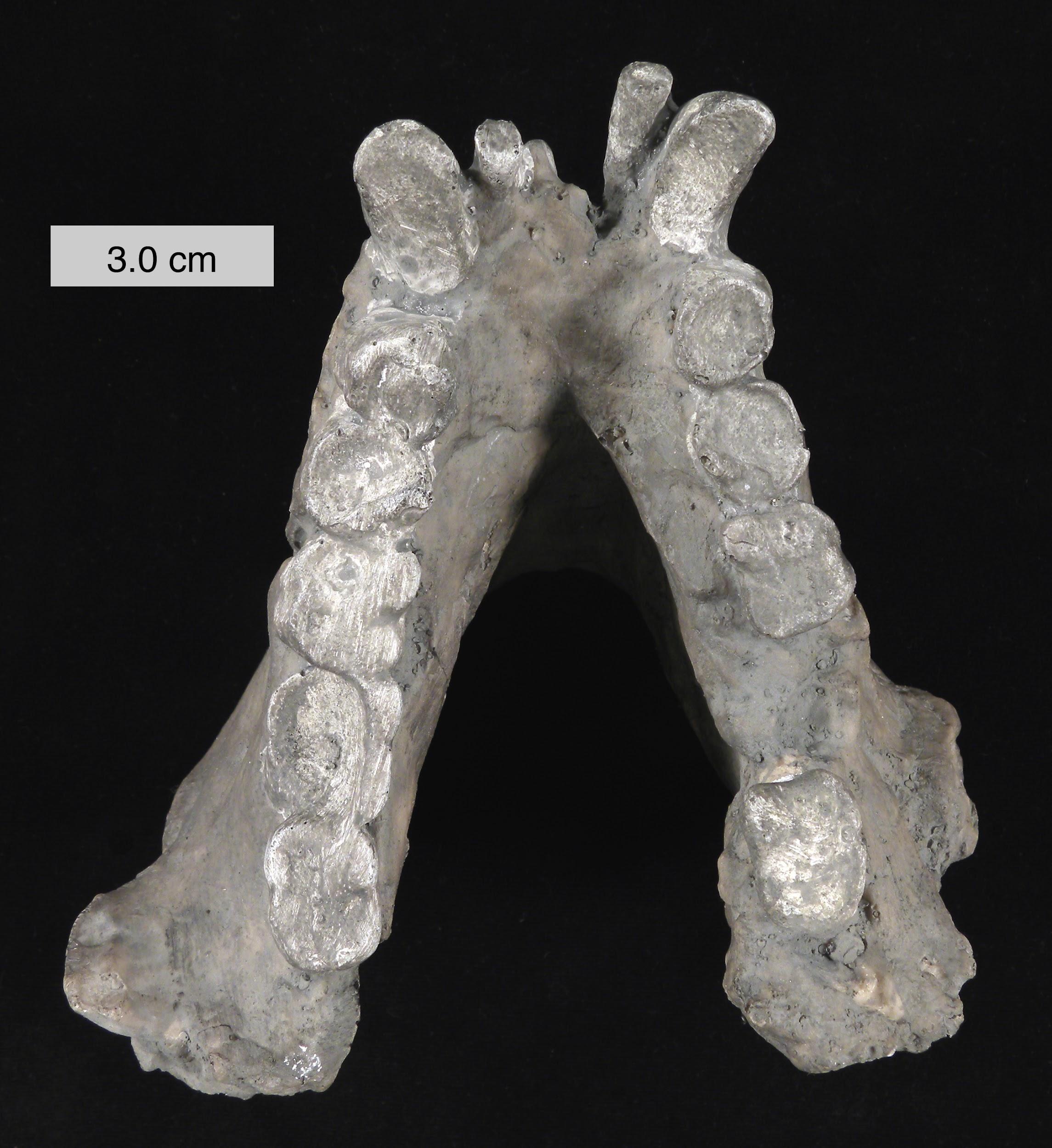 Superior view of mandible and teeth.